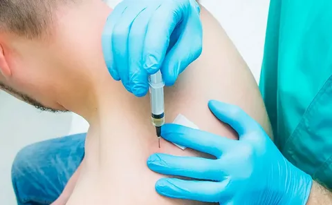 trigger point injections